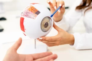 Kontaktlencse kisokos